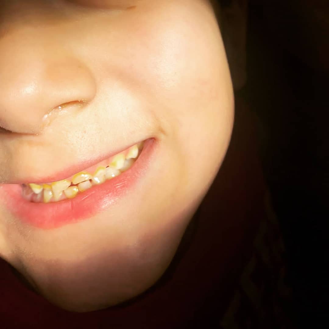 Rasheed Dental Surgery Bahawalpur