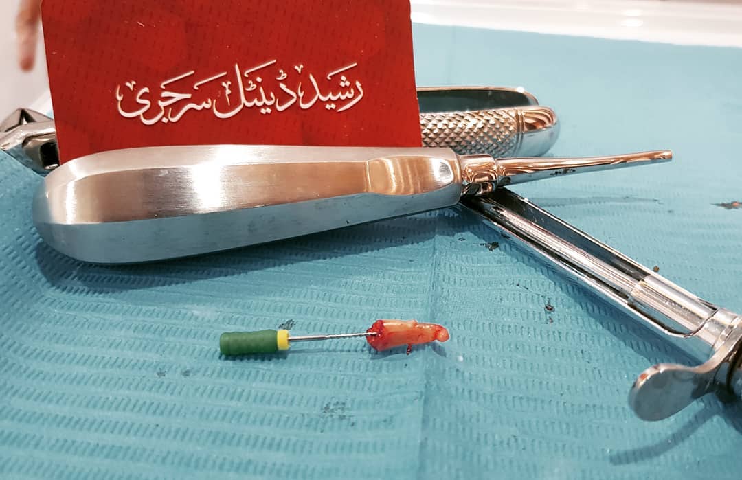 Dental Care Bahawalpur