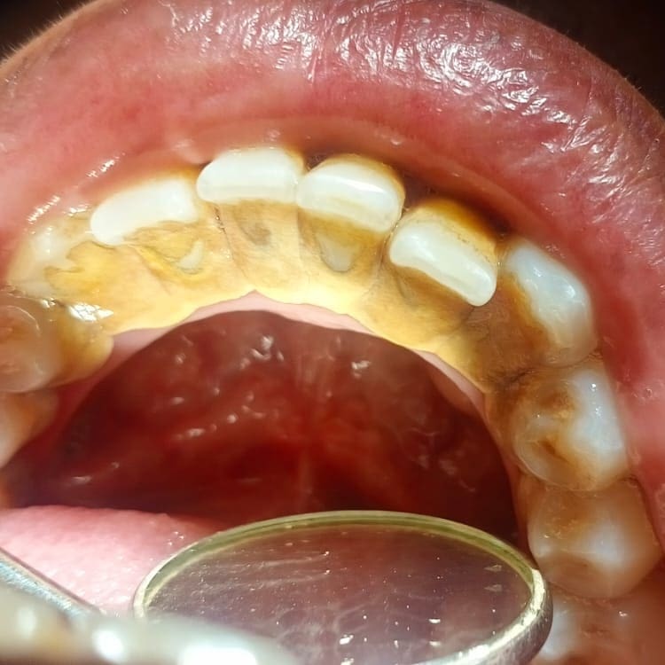 Rasheed Dental Surgery Gallery 5