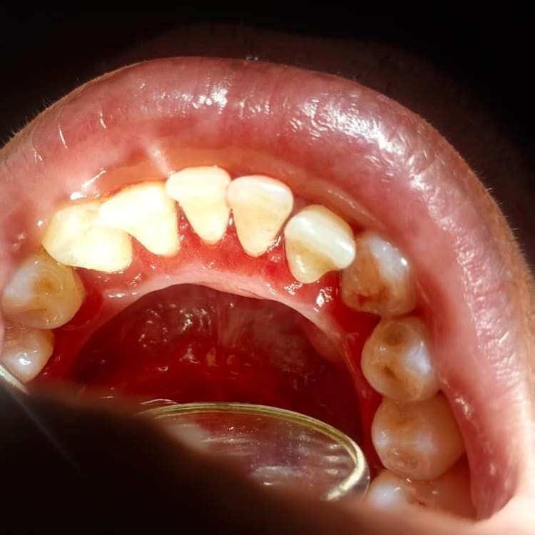 Rasheed Dental Surgery Gallery 6