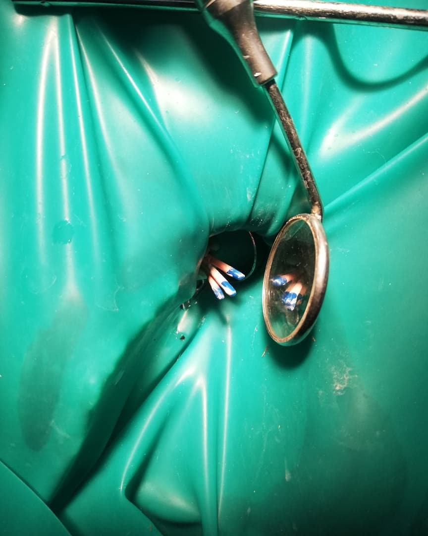 Teeth Whitening Bahawalpur