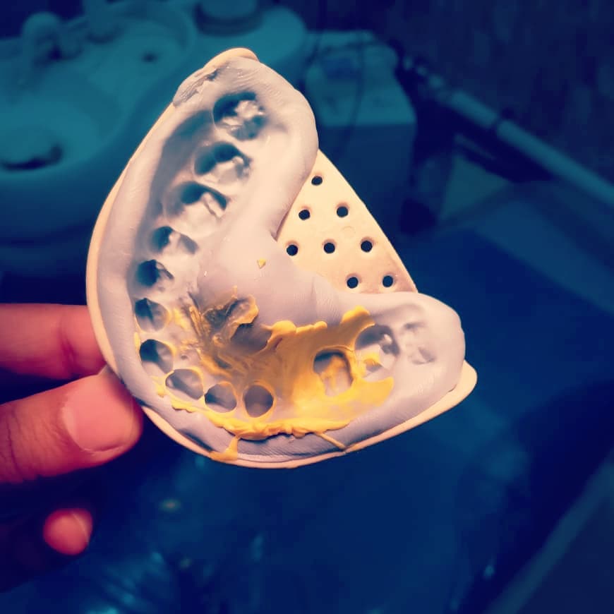 Dental Implants Bahawalpur